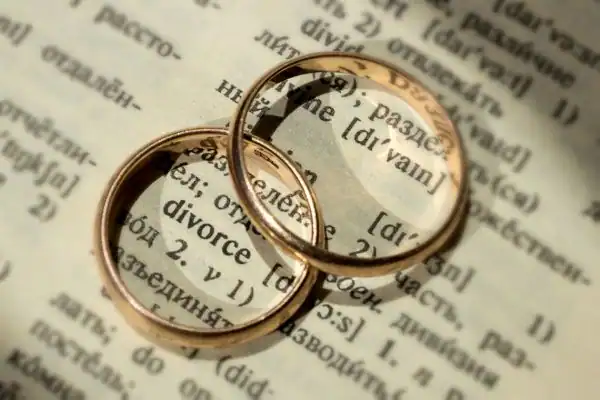 Image of rings removed before divorce mediation Grimsby